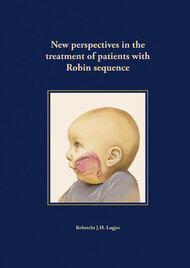 New perspectives in the treatment of patients with Robin sequence