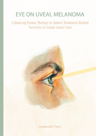 Eye on Uveal Melanoma