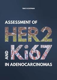 Assessment of HER2 and Ki67 in adenocarcinomas