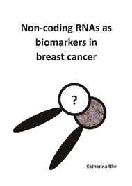 Non-coding RNAs as biomarkers in breast cancer
