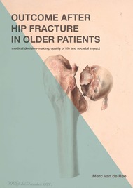 Outcome after hip fracture in older patients