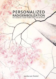 Personalized radioembolization for colorectal cancer patients with liver metastases