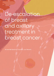 De-escalation of breast and axillary treatment in breast cancer patients