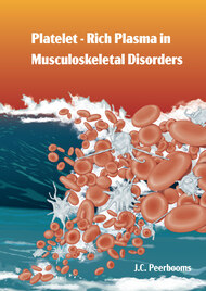 Platelet-Rich Plasma in Musculoskeletal Disorders