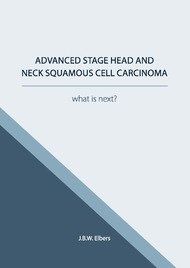 Advanced stage head and neck squamous cell carcinoma