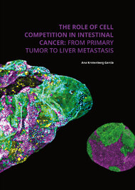 The Role Of Cell Competition In Intestinal Cancer: From Primary Tumor To Liver Metastasis