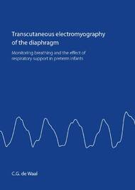 Transcutaneous electromyography of the diaphragm