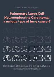 Pulmonary Large Cell Neuroendocrine Carcinoma: a unique type of lung cancer?