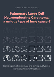 Pulmonary Large Cell Neuroendocrine Carcinoma: a unique type of lung cancer?
