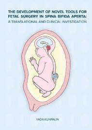 The development of novel tools for fetal surgery in spina bifida aperta: