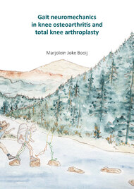 Gait neuromechanics in knee osteoarthritis and total knee arthroplasty