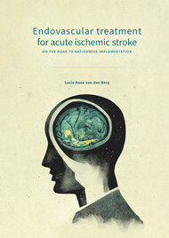 Endovascular treatment for acute ischemic stroke