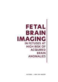 Fetal brain imaging