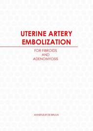 UTERINE ARTERY EMBOLIZATION