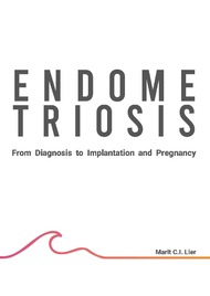 Endometriosis