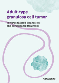 Adult-type granulosa cell tumor