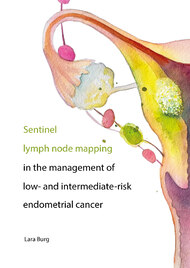 Sentinel lymph node mapping in the management of low- and intermediate-risk endometrial cancer