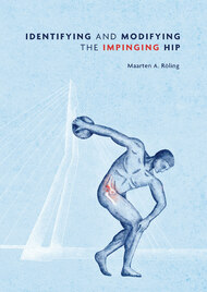 Identifying and modifying the impinging hip