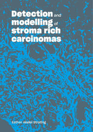 Detection and modelling of stroma rich carcinomas
