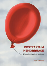 Postpartum hemorrhage