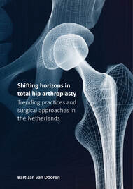 Shifting horizons in total hip arthroplasty
