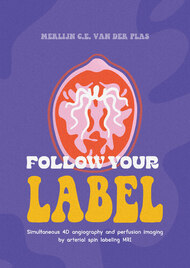 Follow your label