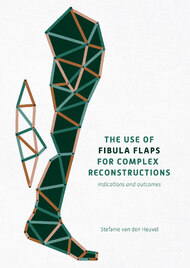 The Use of Fibula Flaps for Complex Reconstructions