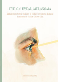 Eye on Uveal Melanoma