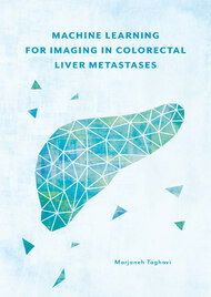 Machine learning for imaging in colorectal liver metastases 