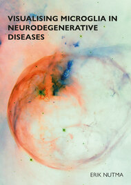 Visualising microglia in neurodegenerative diseases