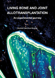 Living bone and joint allotransplantation