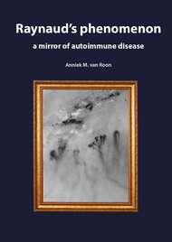 Raynaud’s phenomenon: a mirror of autoimmune disease