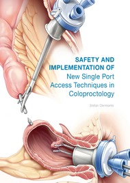 Safety and Implementation of New Single Port