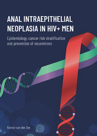 Anal intraepithelial neoplasia in HIV+ men: