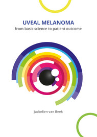 Uveal melanoma