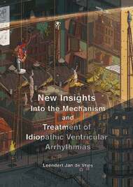 New Insights into the Mechanism and Treatment of Idiopathic Ventricular Arrhythmias
