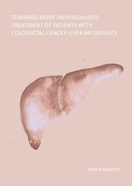 Towards more individualized treatment of patients with colorectal cancer liver metastases