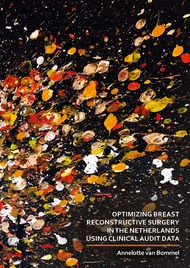Optimizing breast reconstructive surgery in the Netherlands using clinical audit data