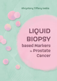 Liquid Biospy based Markers in Prostate Cancer