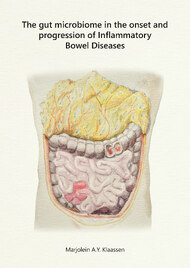 The gut microbiome in the onset and progression of Inflammatory Bowel Diseases