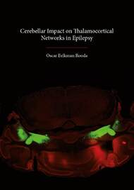 Cerebellar Impact on Thalamocortical Networks in Epilepsy