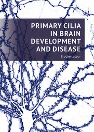 Primary cilia in brain development and disease