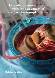 Extended preservation and viability assessment of the liver for transplantation