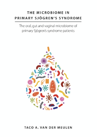 The microbiome in primary Sjögren’s syndrome