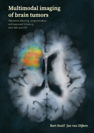 Multimodal imaging of brain tumors