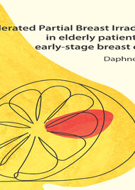 Accelerated Partial Breast Irradiation in elderly patients with early-stage breast cancer
