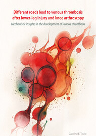 Different roads lead to venous thrombosis after lower-leg injury and knee arthroscopy