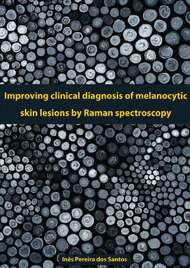 Improving Clinical Diagnosis of Melanocytic Skin Lesions by Raman Spectroscopy