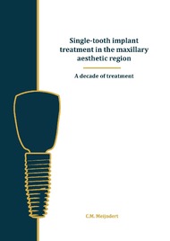 Single-tooth implant treatment in the maxillary aesthetic region.