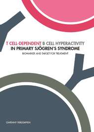 T cell-dependent B cell hyperactivity in primary Sjögren’s syndrome